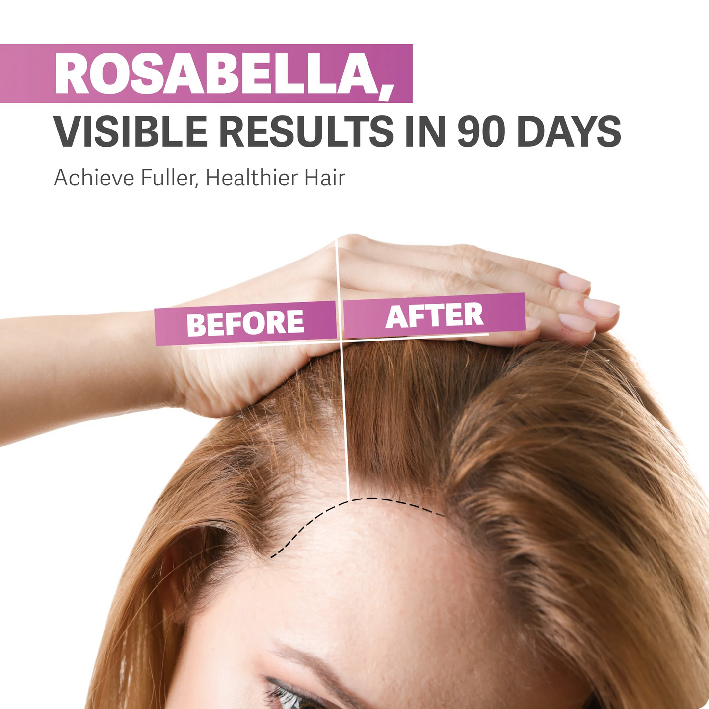 Rosabella Hair Growth Vitamin Gummies
