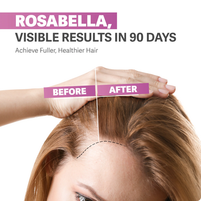 Rosabella Hair Growth Vitamin Gummies